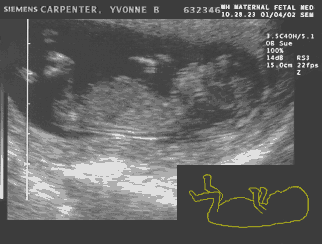 MY's looking good at 12 weeks