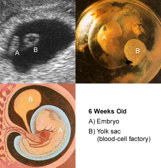 Baby Carpenter at 6 weeks compared to a book baby