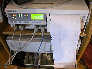 Monitor - 144 is Kyla's heartrate, 55 is Yvonne's contraction level