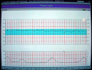 Monitor - top is Kyla's heartrate, bottom Yvonne's contractions